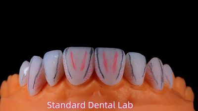 Standard Dental Lab Co., Limited üreticinin üretim hattı