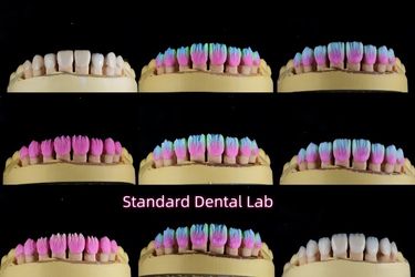 Standard Dental Lab Co., Limited üreticinin üretim hattı