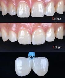 Standard Dental Lab Co., Limited üreticinin üretim hattı
