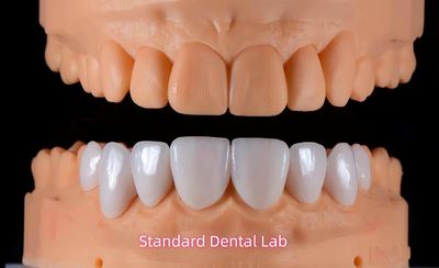 Standard Dental Lab Co., Limited üreticinin üretim hattı