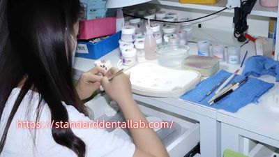 Standard Dental Lab Co., Limited üreticinin üretim hattı