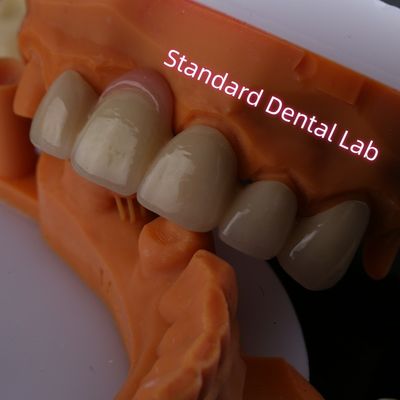 satın al Yüksek oranda biyolojik uyumlu, pembe sakızlı porselen katmanlı zirkonya çevrimiçi üretim