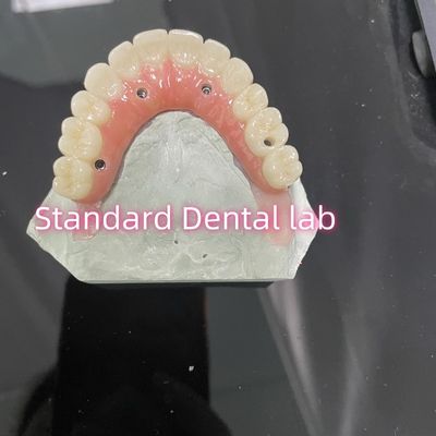 satın al All On Four Six Ivoclar Zirconia İmplant Köprüsü Pembe Sakız Porselenli Titanyum Çubuk çevrimiçi üretim