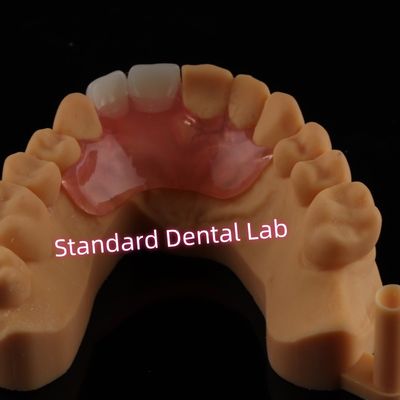 satın al Dental Valplast Esnek Flipper Diş Dişleri Alınabilir Kısmi Diş Dişleri çevrimiçi üretim