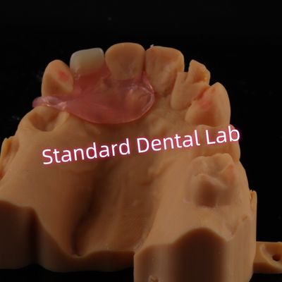satın al Üst Valplast Tek taraflı Diş Protezleri Kaldırılabilir Esnek Bir Diş Kısmi Dişler çevrimiçi üretim