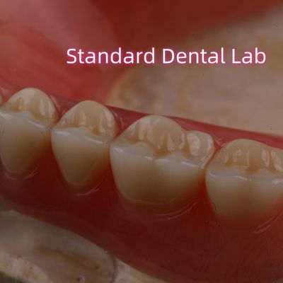 satın al SDL Sıcak Dondurulmuş Akrilik Kısmi Diş Protezi Ivoclar Dişler Diş Laboratuvarı Yüksek hassasiyet çevrimiçi üretim