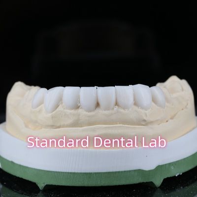 satın al Diagnostik Restoratif Diş Hekimliği Balmumu Yükleme Yaprakları Yüksek Estetik çevrimiçi üretim