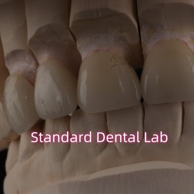 satın al Profesyonel Diş Laboratuvarı Sabit Restorasyon için Zirkonya Tacı çevrimiçi üretim