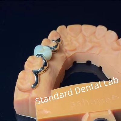 satın al Diş Dişleri PFM Maryland Köprüsü Yüksek Estetik FDA Sertifikalı çevrimiçi üretim