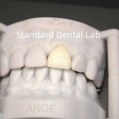 satın al Dijital CAD CAM Diş Laboratuvarı Taçları Şeffaf Katmanlı Zirkonya Tacı çevrimiçi üretim