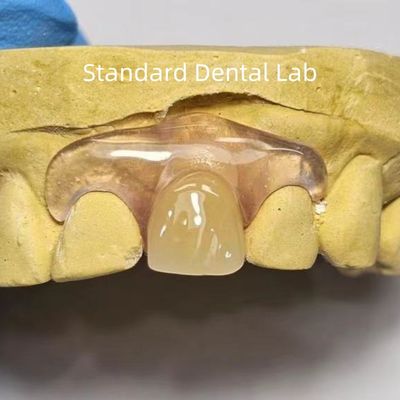 satın al Diş TCS Valplast Esnek Kısmi Diş Dişleri Boyanma Soluma Kokusu Direnişli çevrimiçi üretim