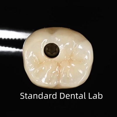 satın al Dental implant tacı, vida ile tutulur çevrimiçi üretim
