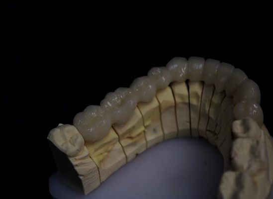 satın al Katmanlı Porselen Erimiş Zirkonya çevrimiçi üretim