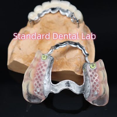 satın al Çıkarılabilir hassas takma Yeni Ace Valplast Kısmi Diş Ekimi Pembe / Koyu çevrimiçi üretim