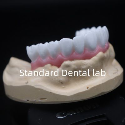 satın al Yüksek Estetik Beyaz Diş Tacı Diagnostik Balmumu Özel Çin Diş Laboratuvarı çevrimiçi üretim