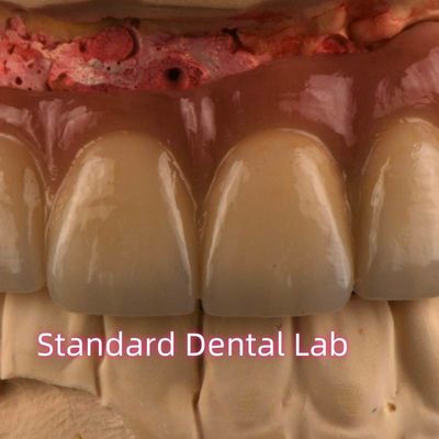 satın al CAD CAM frezeleme PFM Metal sabit köprüye erimiş değersiz porselen çevrimiçi üretim