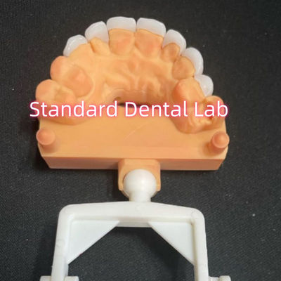 satın al Doğal Görünümlü Laminat Zirkonya Emax Finerleri Kalınlığı 0.6mm çevrimiçi üretim