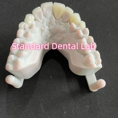 satın al Yıldızların Gülümseme Diş Dişleri Emax Zirkonya Laminat Finerleri 0.6mm çevrimiçi üretim