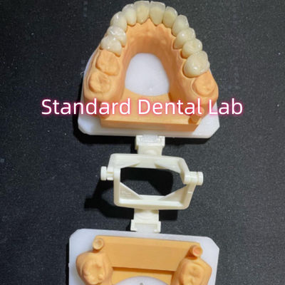 satın al Dental Restoratif Diş Hekimliği Ağız Bakımı Tam Zirkonya Tacı Özel çevrimiçi üretim