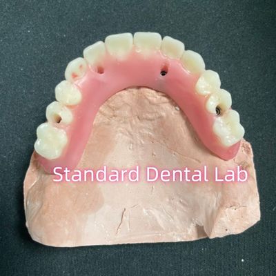 satın al Akrilik kısmi implant diş protezi üzerinde Tizyum çubuğu Tam diş protezi Dişler kurulmuş vida tutulmuş çevrimiçi üretim