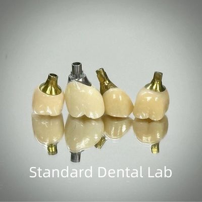 satın al Profesyonel Zirkonya vida tutulmuş implant tacı Titanyum CAD CAM çevrimiçi üretim