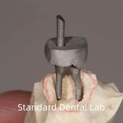 satın al Diş Restorasyonu Metal direği ve çekirdek tacı mükemmel uyum çevrimiçi üretim