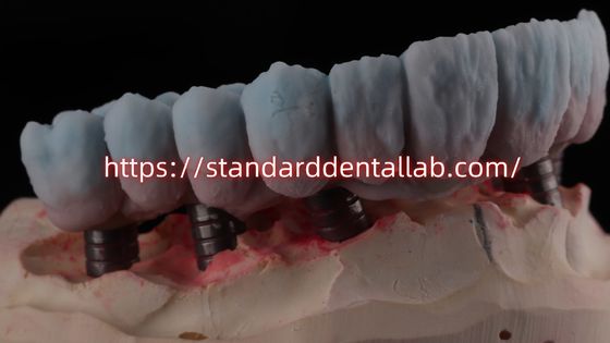 satın al Titanyum Abutment Yüksek Estetikli İmplant Desteklenen Zirkonya Köprüsü çevrimiçi üretim