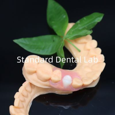 satın al Estetik Valplast Esnek Diş Dişleri 3 Günde Ücretsiz Dönüştürme Politikasıyla Çin Diş Laboratuarı çevrimiçi üretim