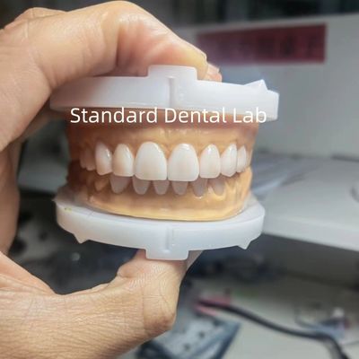 satın al Mükemmel Estetik Çin Diş Laboratuvarı'ndan diş balmumu kullanan diş hekimleri için geçici balmumu çevrimiçi üretim