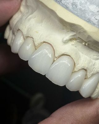 satın al En iyi işlevsellik ve doğal estetik için şeffaflık katmanlı zirkonya tacı çevrimiçi üretim
