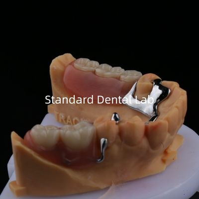 satın al Alaşımlı Metal Kısmi Diş Dişleri Çerçeve 3 Şekil Exocad Lazer Baskı Alt dökme Kısmi Finish çevrimiçi üretim