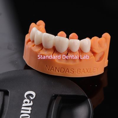 satın al Dijital CAD CAM Diş Laboratuvarı ile Rahatlık ve İşlevsellik Şeffaf Katmanlı Zirkonya Köprüsü çevrimiçi üretim