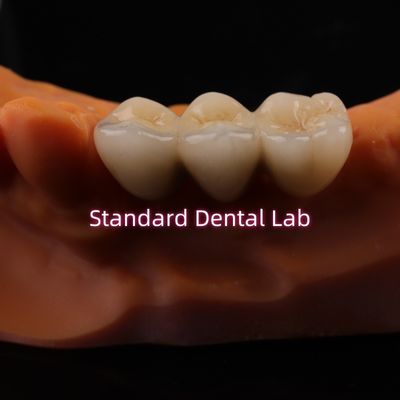 satın al Dijital CAD CAM Diş Laboratuvarı Taçları Şeffaf Katmanlı Zirkonya Tacı çevrimiçi üretim