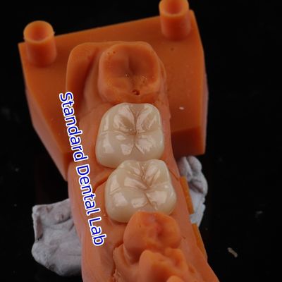 satın al Tam Kontür Zirkonya tacı şeffaflığı 3D PRO Porselen örtümü yok Standart Diş Laboratuvarı çevrimiçi üretim