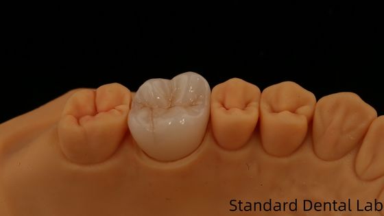 satın al Noritake Porselen Dental Lab tarafından Estetik Dijital Diş Restorasyonu için Özel Vita Gölgesi çevrimiçi üretim