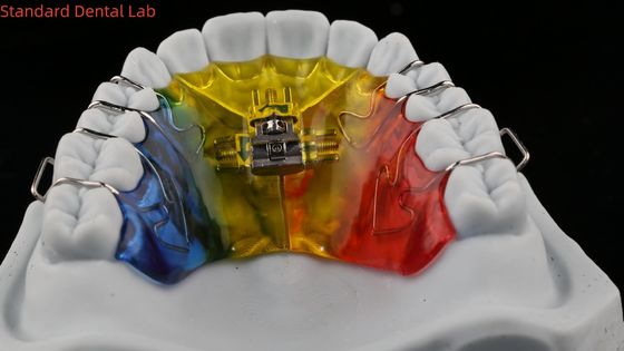 satın al Diş Genişletme ve Distalizasyon Ortodontist Palat Genişletme Çin Diş Laboratuarı çevrimiçi üretim