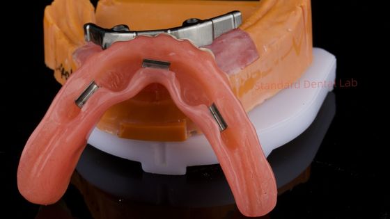 satın al Ivoclar Dijital Diş İmplantı Bar Diş Dentüsü Eklemlerle Tam Akrilik Diş Dentüsü Titanyum Dentüsü Destekli Diş Dentüsü çevrimiçi üretim