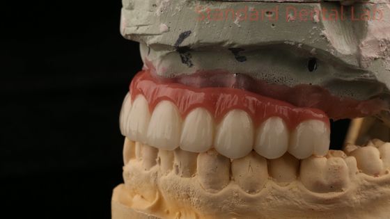 satın al Hibrit Titanyum vida tutulmuş diş implantı tacı tüm 4 diş implantı zirkonya köprüsü çevrimiçi üretim