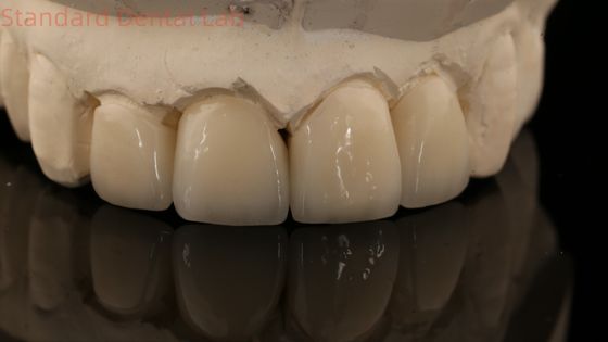 satın al Güçlü Katmanlı Zirkonya Tacı ve Köprüsü İyi Estetikte Zirkonya Katmanlı Çin Diş Laboratuarı çevrimiçi üretim