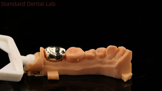 satın al Yüksek Nobel Sarı Altın Taç Diş Profesyonel Ni Be Free ISO ve FDA onaylı Çin Diş Laboratuarı çevrimiçi üretim