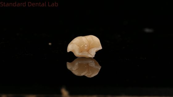 satın al Güçlü Emax Seramik Taç Diş Onlay mükemmel leke direnci ile Çin Diş Laboratuvarı çevrimiçi üretim