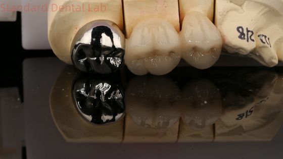satın al Vita Porselen Dental Laboratuvarı 3 yıllık garanti ile tam metal taç çevrimiçi üretim