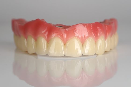 satın al Tam kemerli zirkonya implant köprüsü 4 / 6 diş implantı hızlı iyileşme çevrimiçi üretim