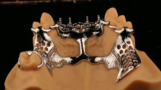 satın al Yukarı dökme çerçeve Akrilik metal kısmi dişler Güçlü hafif ve dayanıklı çevrimiçi üretim