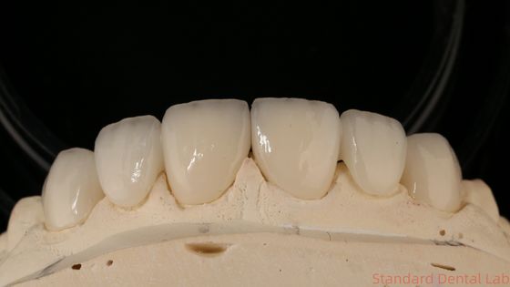 satın al Kesin Zirconia Taç Köprüsü Rahat Uyum / Estetik 3-4 Gün Hızlı dönüş süresi çevrimiçi üretim