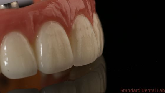 satın al Profesyonel Zirkonya Diş İmplantı Tacı Titanyum CAD CAM Zirkonya Tacı Çin Diş Laboratuarı çevrimiçi üretim