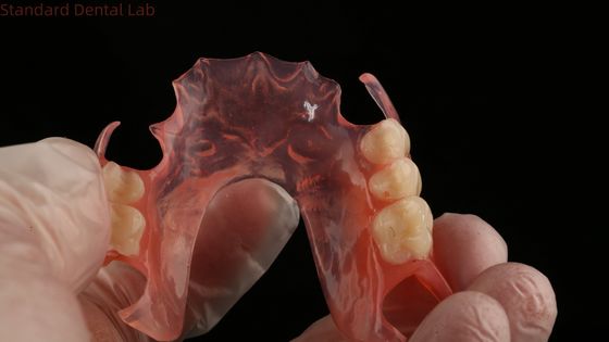 satın al Ace Dişler Pembe/Koyu TCS Valplast Yüksek Estetik için Esnek Kısmi Diş Dişleri Diş 3D Baskı Modeli çevrimiçi üretim