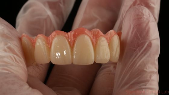 satın al Porselen All On Four Zirkonya Köprüsü Yüksek Estetik Diş İmplantı Köprüsü çevrimiçi üretim