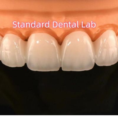 Zirkonya Taç Köprüsü Dental Laboratuvarı Katmanlı Porselenle