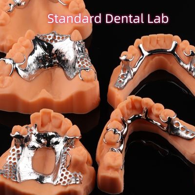 Yazdırılmış CoCr Diş Dentüsü Skelet Chrome Metal Kısmi Diş Dentüsü Tasarımı